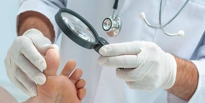 The doctor examines the patient's foot with a magnifying glass