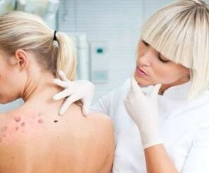 Symptoms of the virus of the human papillo