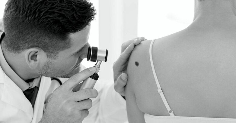 the specialist diagnoses the type of warts