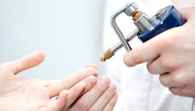 Cryodruction as a method of treatment of nipples