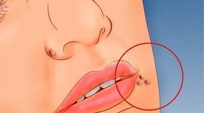 Reasons to appear nipples